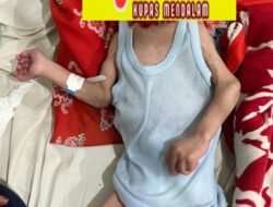 AKTIVIS MENGAMUK! Dugaan Kelalaian Penanganan Stunting di Rajabasa Disorot, Minta Audit Total